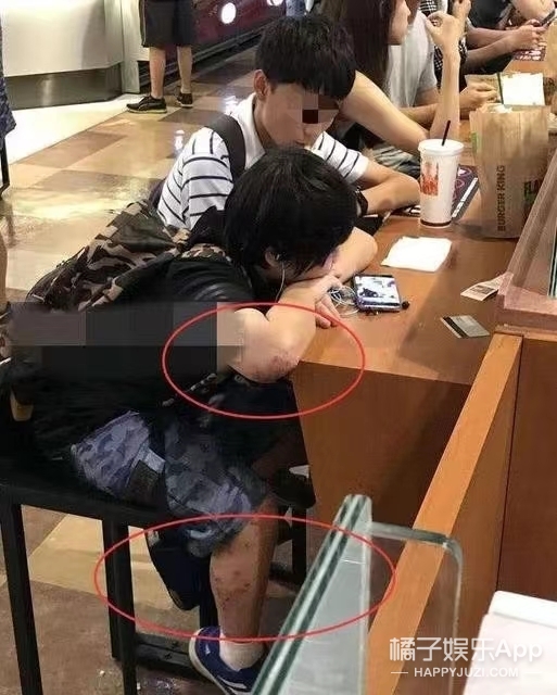 下一站幸福小小彬花絮,下一站幸福小小彬得的病