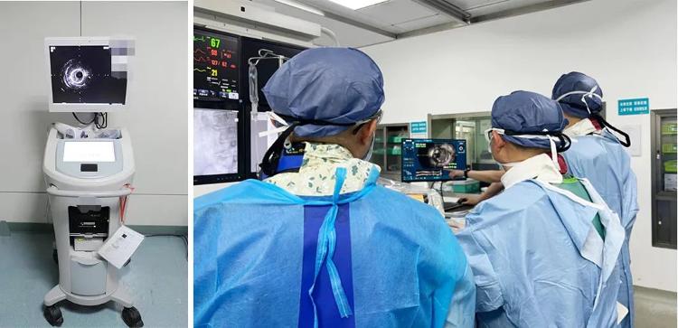 横州人民医院介入治疗冠心病,血管内超声检查冠心病的精准度